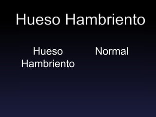 Hueso Hambriento
Normal
Hueso
Hambriento
 