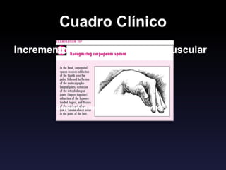 Cuadro Clínico
Incremento excitabilidad neuromuscular
Deposición de calcio en tejidos blandos
 