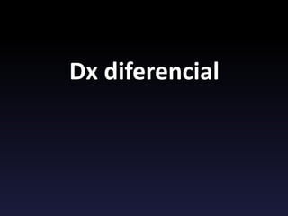 Dx diferencial
 