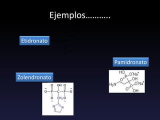 Ejemplos………..
Pamidronato
Etidronato
Zolendronato
 
