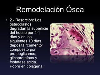 Remodelación Ósea
• 2.- Resorción: Los
osteoclastos
degradan la superficie
del hueso por 4-1
días y en los
siguientes 10 días
deposita “cemento”
compuesto por
proteoglicanos,
glicoproteínas y
fosfatasa ácida.
Pobre en colágena.
 