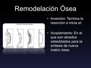 Remodelación Ósea
• Inversión: Termina la
resorción e inicia el:
• Acoplamiento: En el
que son atraidos
osteoblastos para la
síntesis de nueva
matriz ósea.
 