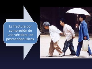 La fractura por
compresión de
una vértebra: en
posmenopáusicas.
 