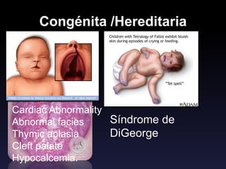 Congénita /Hereditaria
Síndrome
Poliglandular
autoinmune tipo I
Síndrome de
DiGeorge
Cardiac Abnormality
Abnormal facies
Thymic aplasia
Cleft palate
Hypocalcemia.
C
A
T
C
H
 