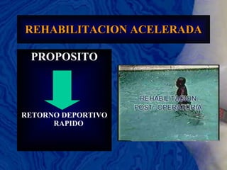 REHABILITACION ACELERADA PROPOSITO RETORNO DEPORTIVO RAPIDO 