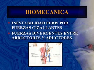 BIOMECANICA INESTABILIDAD PUBIS POR FUERZAS CIZALLANTES FUERZAS DIVERGENTES ENTRE ABDUCTORES Y ADUCTORES 