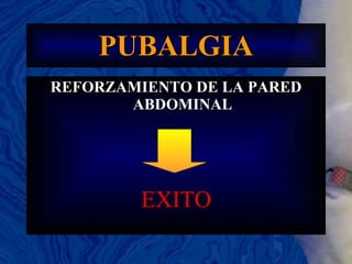 PUBALGIA REFORZAMIENTO DE LA PARED ABDOMINAL EXITO 