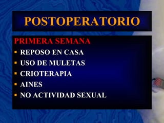 POSTOPERATORIO PRIMERA SEMANA REPOSO EN CASA USO DE MULETAS CRIOTERAPIA AINES NO ACTIVIDAD SEXUAL   