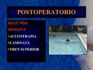 POSTOPERATORIO SEGUNDA SEMANA ACUOTERAPIA  CAMINATA TREN SUPERIOR 