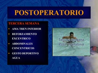 POSTOPERATORIO TERCERA SEMANA AMA TREN INFERIOR REFORZAMIENTO EXCENTRICO ABDOMINALES CONCENTRICOS GESTO DEPORTIVO AGUA 