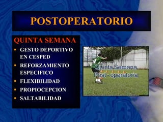 POSTOPERATORIO QUINTA SEMANA GESTO DEPORTIVO EN CESPED REFORZAMIENTO ESPECIFICO FLEXIBILIDAD PROPIOCEPCION SALTABILIDAD 