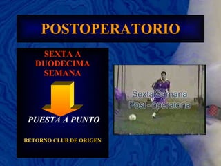 POSTOPERATORIO SEXTA A DUODECIMA SEMANA PUESTA A PUNTO RETORNO CLUB DE ORIGEN 