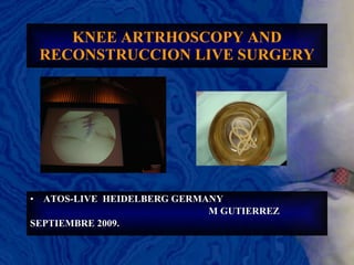 KNEE ARTRHOSCOPY AND RECONSTRUCCION LIVE SURGERY ATOS-LIVE  HEIDELBERG GERMANY  M GUTIERREZ SEPTIEMBRE 2009. 
