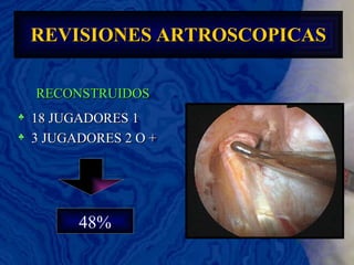 REVISIONES   ARTROSCOPICAS 48% RECONSTRUIDOS 18 JUGADORES 1  3 JUGADORES 2 O + 