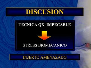 DISCUSION TECNICA QX  IMPECABLE STRESS BIOMECANICO INJERTO AMENAZADO 