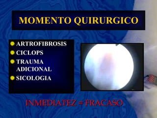 MOMENTO QUIRURGICO ARTROFIBROSIS CICLOPS TRAUMA ADICIONAL SICOLOGIA INMEDIATEZ = FRACASO 