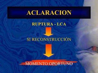 RUPTURA - LCA ACLARACION SI RECONSTRUCCIÓN MOMENTO OPORTUNO 