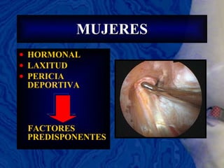 MUJERES HORMONAL LAXITUD PERICIA DEPORTIVA FACTORES PREDISPONENTES 