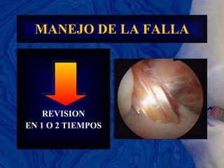 MANEJO DE LA FALLA REVISION EN 1 O 2 TIEMPOS 
