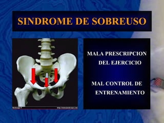 SINDROME DE SOBREUSO MALA PRESCRIPCION DEL EJERCICIO MAL CONTROL DE ENTRENAMIENTO 