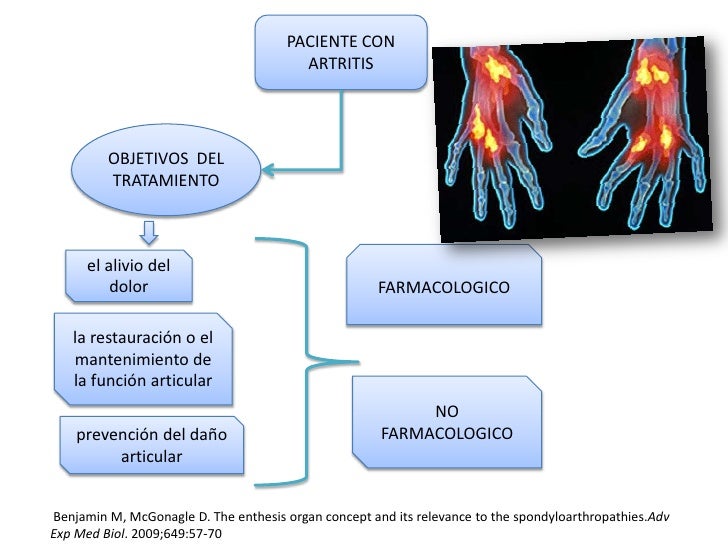enthesis organ concept its relevance Autoinflammatory dysregulation centered at the synovial-entheseal complex 26 benjamin m, mcgonagle d the enthesis organ concept and its relevance to. enthesis organ concept its relevance Autoinflammatory dysregulation centered at the synovial-entheseal complex 26 benjamin m, mcgonagle d the enthesis organ concept and its relevance to.