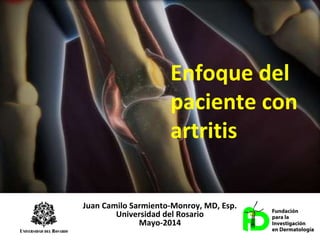Juan Camilo Sarmiento-Monroy, MD, Esp.
Universidad del Rosario
Mayo-2014
Enfoque del
paciente con
artritis
 