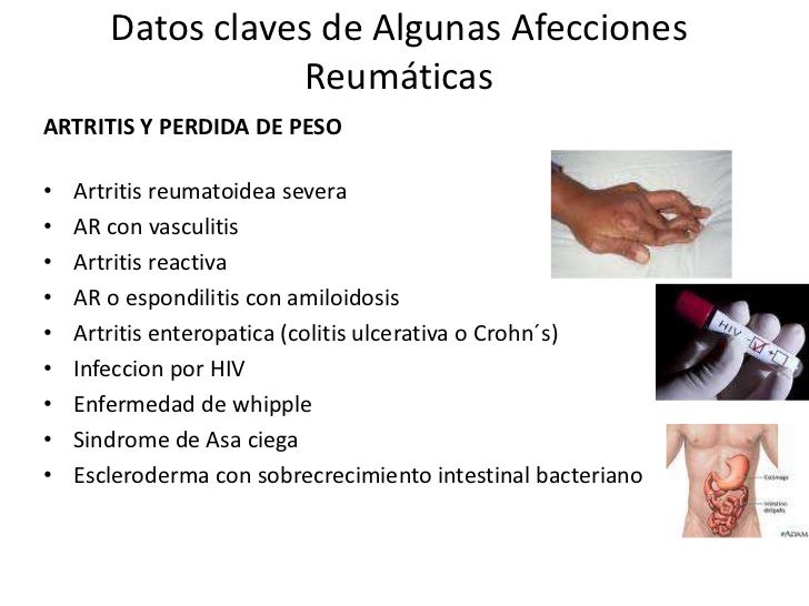 enfermedad de cadenas ligeras pdf enfoque del paciente con enfermedad reumatologica enfermedad de cadenas ligeras pdf enfoque del paciente con enfermedad reumatologica