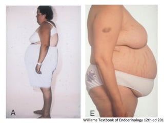 Williams	
  Textbook	
  of	
  Endocrinology	
  12th	
  ed	
  2011
 