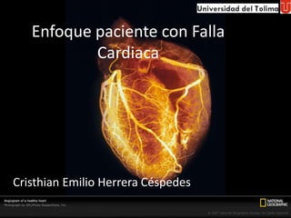Enfoque paciente con Falla Cardiaca Cristhian Emilio Herrera Céspedes 