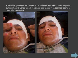 •Cortamos pedazos de venda a la medida requerida, acto seguido
sumergimos la venda en el recipiente con agua y colocamos sobre el
rostro del compañero.
 