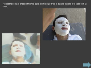 Repetimos este procedimiento para completar tres a cuatro capas de yeso en la
cara.
 