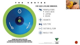 Enfoque vortex exposicion.pptx