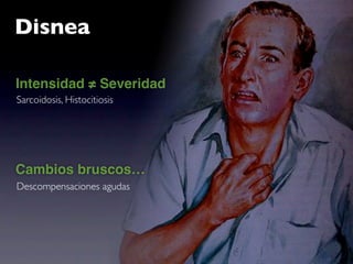 Disnea

Intensidad ≠ Severidad
Sarcoidosis, Histocitiosis




Cambios bruscos…
Descompensaciones agudas
 