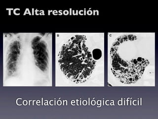 TC Alta resolución




 Correlación etiológica difícil
 