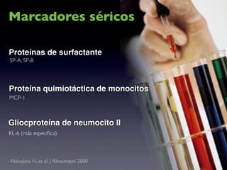 Marcadores séricos

Proteínas de surfactante
SP-A, SP-B




Proteína quimiotáctica de monocitos
MCP-1



Gliocproteína de neumocito II
KL-6 (más especíﬁca)



–Nakajima H, et al. J Rheumatol 2000
 