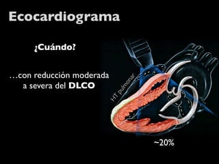 Ecocardiograma

     ¿Cuándo?


…con reducción moderada




                                ar
                             on
  a severa del DLCO


                             lm
                          pu
                      HT



                                     ~20%
 