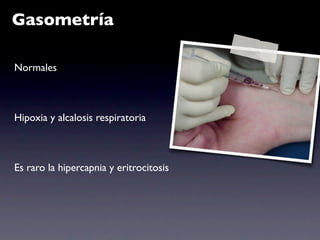 Gasometría

Normales



Hipoxia y alcalosis respiratoria



Es raro la hipercapnia y eritrocitosis
 