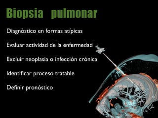Diagnóstico en formas atípicas

Evaluar actividad de la enfermedad

Excluir neoplasia o infección crónica

Identiﬁcar proceso tratable

Deﬁnir pronóstico
 