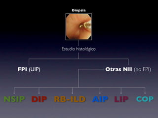 Biopsia




              Estudio histológico



  FPI (UIP)                         Otras NII (no FPI)




NSIP DIP RB-ILD AIP LIP COP
 