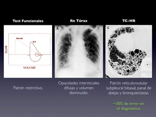 Test Funcionales             Rx Tórax                      TC-HR




                      Opacidades intersticiales     Patrón reticulonodular
Patrón restrictivo.     difusas y volumen         subpleural bibasal, panal de
                            disminuido.            abejas y bronquiectasias.

                                                      ~30% de error en
                                                        el diagnóstico
 