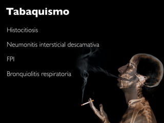 Tabaquismo
Histocitiosis

Neumonitis intersticial descamativa

FPI

Bronquiolitis respiratoria
 