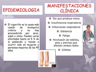 EPIDEMIOLOGIA
 El cigarrillo es la causa más
común de bronquitis
crónica y no hay
precondición por sexo,
edad o etnia. Pueden verse
afectados hasta un 5 % de
la población y tiende a
ocurrir más en mujeres y
personas mayores de los 45
años
 Tos que produce moco
 Insuficiencia respiratoria
 Infecciones respiratoria
 Sibilancia
 Fatiga
 Hinchazón de tobillos,
pies y piernas que
afectan ambos lados
 Cefalea
MANIFESTACIONES
CLÍNICA
 