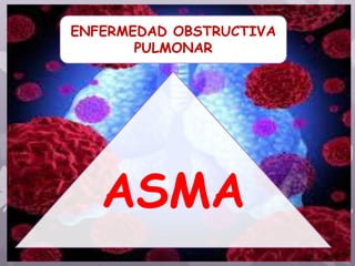 ENFERMEDAD OBSTRUCTIVA
PULMONAR
ASMA
 