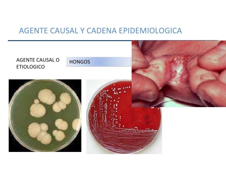 cadena epidemiologica heterologa enf transmisibles cadena epidemiologica heterologa enf transmisibles