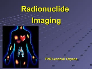 RadionuclideRadionuclide
ImagingImaging
PhD Lenchuk TatyanaPhD Lenchuk Tatyana
 
