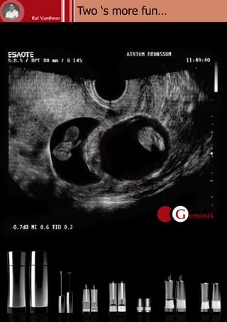 Geminis
69
Do you make an appeal to all your senses while cooking? Then you certainly also use this professional knife set; for, once
you used it, you will never want anything else! The ergonomic and safe handles perfectly match the shape of your hand,
making cutting pure bliss. Thanks to the addition of a metal counterbalance in the handle, you get a perfect balance
between the blade and the handle. In addition, each blade is hand sharpened and provided with a quality label. To all this,
also add the modern design and the beautifully looking wooden knife block (made of non-tropical wood!) and you get an
impressive knife set. Precision, even in the smallest detail …
Philosophy
“Geminis” is the collective term for a whole lot of indispensable kitchen, bar and bathroom items. Most items
have a concave (hollow) and convex (round) shape. Given the fact that these shapes perfectly match (like a
couple), they constitute a harmonious whole. This principle takes shape in the mini saltcellar  pepperpot, the
salt  pepper mill, the oil  vinegar dispenser, the soap dispensers …
Designer: Raf Vanthoor
The master himself, who keeps searching for the time to come up with innovative ideas.
Complete your kitchen!
There is nothing as amusing and relaxing as elaborately barbecuing with family and friends. These barbecue utensils
are handy in use and are perfect for hobby and professional cooking.
 