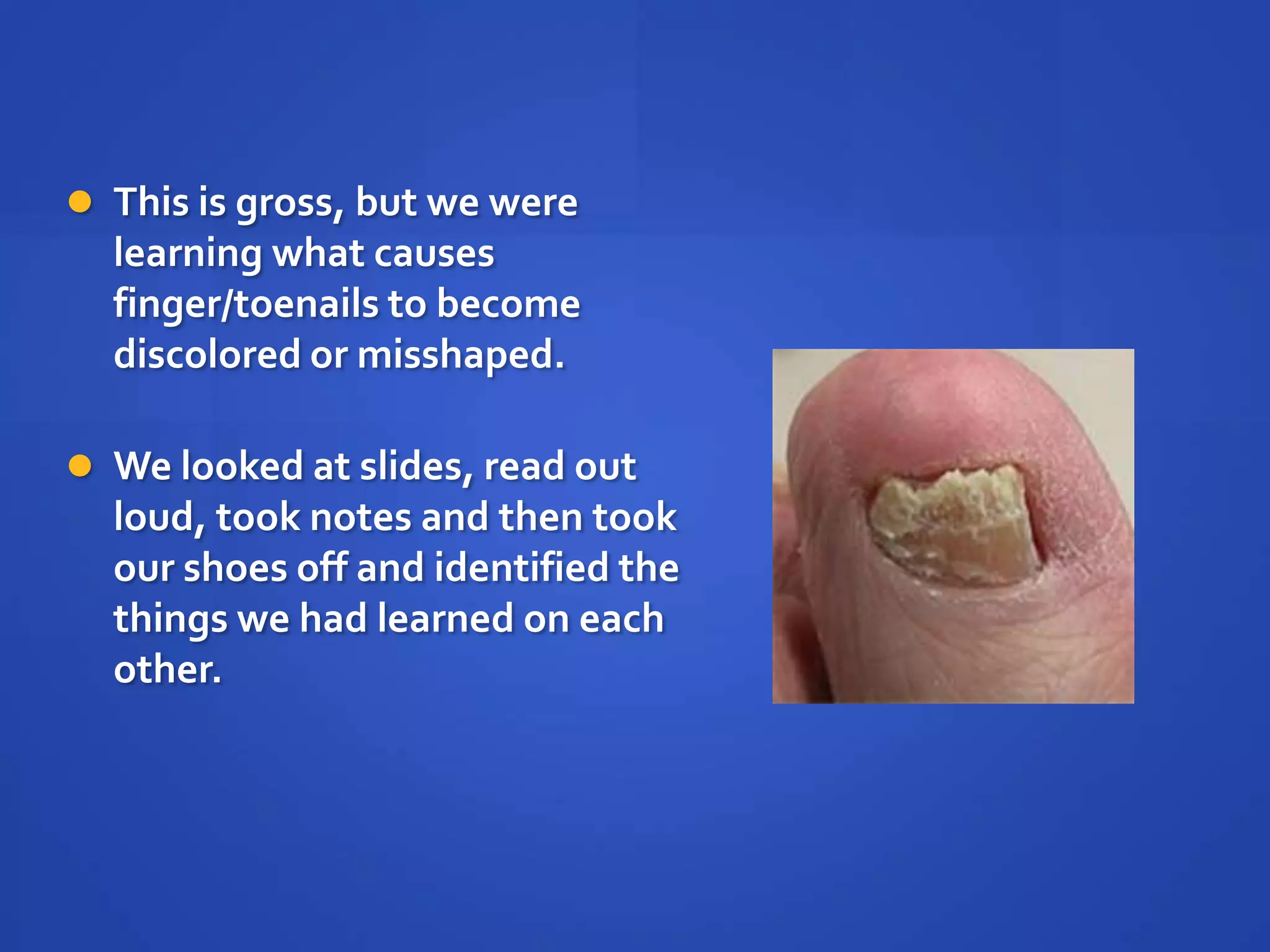  This is gross, but we were
  learning what causes
  finger/toenails to become
  discolored or misshaped.

 We looked at slides, read out
  loud, took notes and then took
  our shoes off and identified the
  things we had learned on each
  other.
 