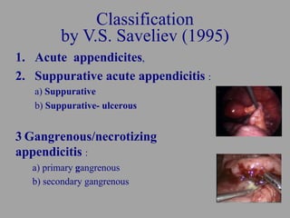 Classification
by V.S. Saveliev (1995)
1. Acute appendicites,
2. Suppurative acute appendicitis :
a) Suppurative
b) Suppur...