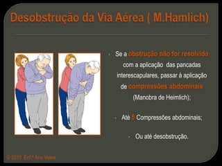 Sinais e SintomasNa obstrução ligeiraTosse