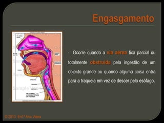  Executar a manobra de Heimlich, em dois minutos, na respectiva sequência;© 2010  Enf.ª Ana Vieira